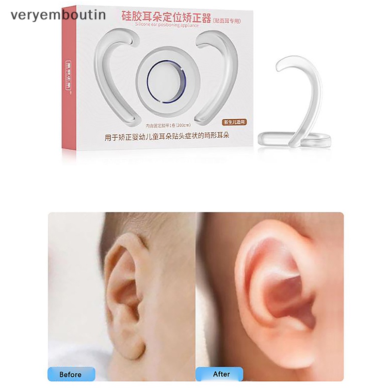 Dụng Cụ Chỉnh Sửa Tư Thế Tai Cho Bé Sơ Sinh
