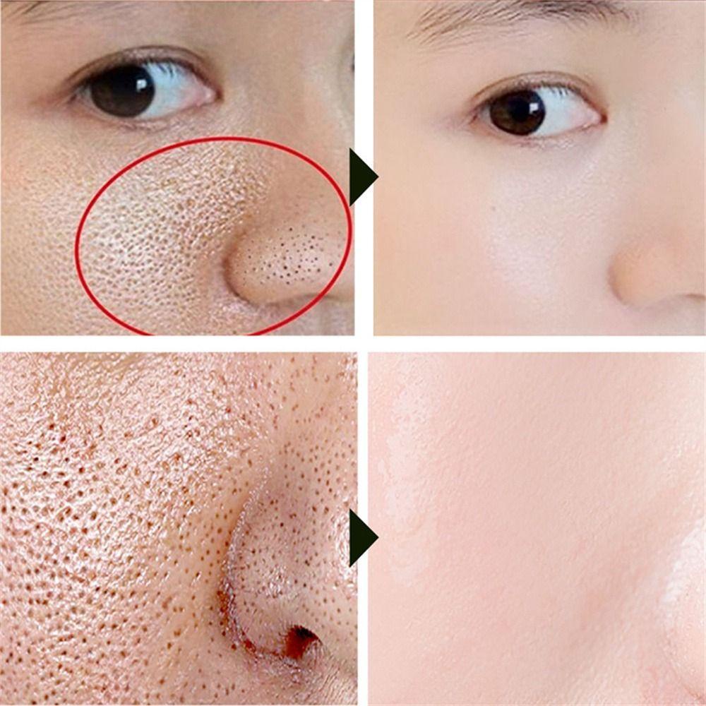 Serum Kiểm Soát Dầu Làm Săn Chắc Da Mặt Se Khít Lỗ Chân Lông 30ml