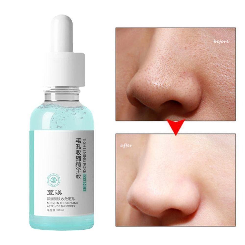 Serum 30ml 30ml Giúp Se Khít Lỗ Chân Lông Và Làm Săn Chắc Da