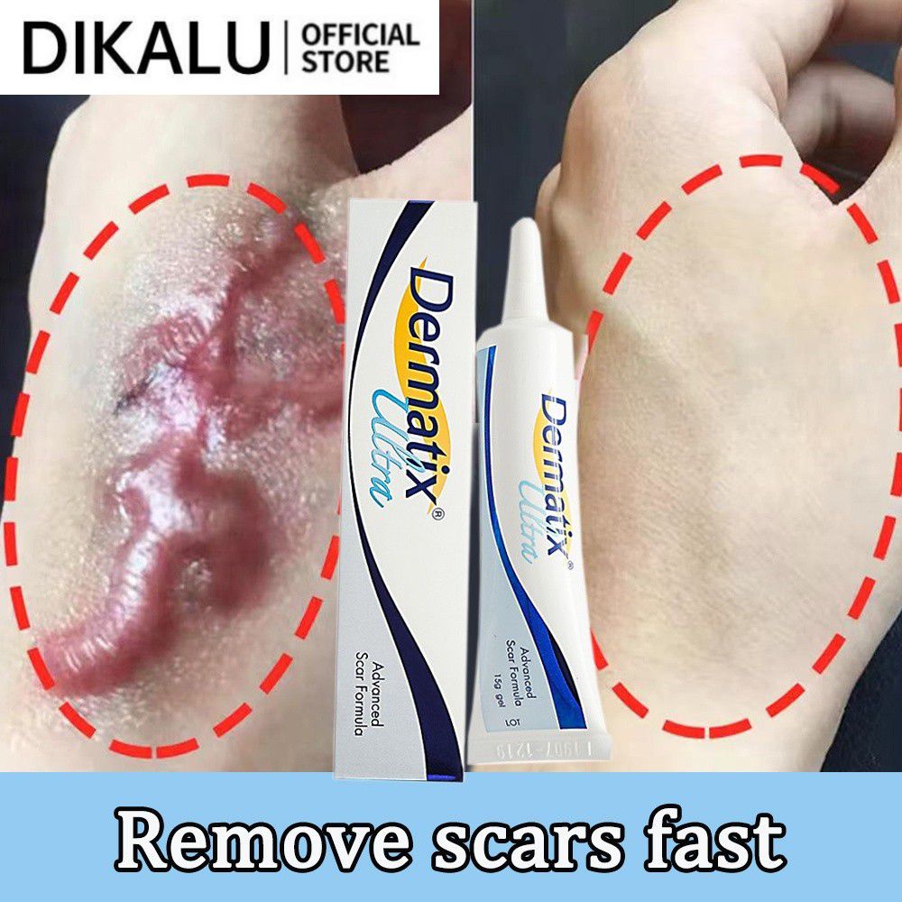 Gel xóa sẹo thâm/ sẹo lồi DIKALU Dermatix Ultra 15g