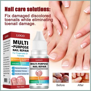 Tinh Chất Phục Hồi Móng Hư Tổn 10ml