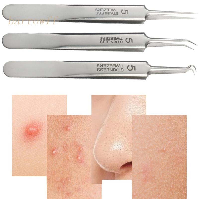 Nhíp Nặn Mụn Đầu Đen / Mụn Trứng Cá Bằng Thép Không Gỉ