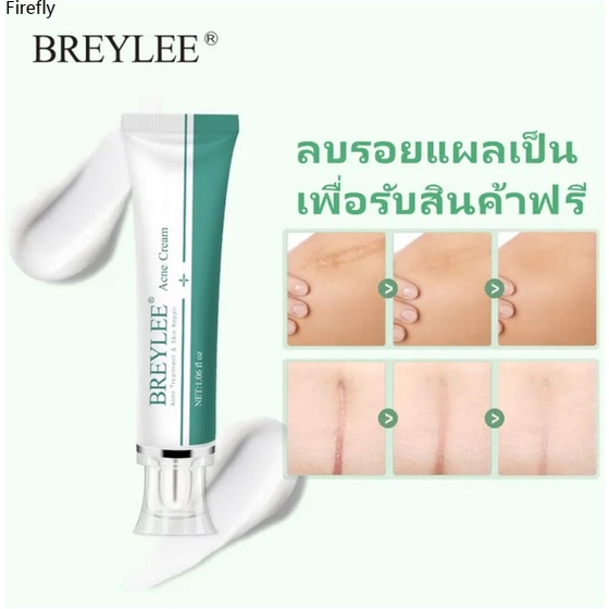 coza 【nhanh chóng】 Kem Trị Sẹo Làm Mờ Sửa Chữa Sẹo Kem Trị Sẹo Mụn 30g