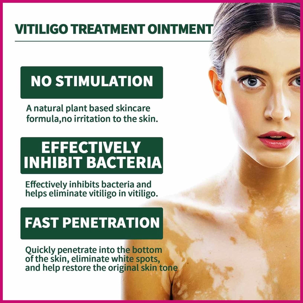 Kem Phục Hồi Da Vitiligo Làm Trắng Xóa Mờ Vết Thâm Và Chống Mồ Hôi