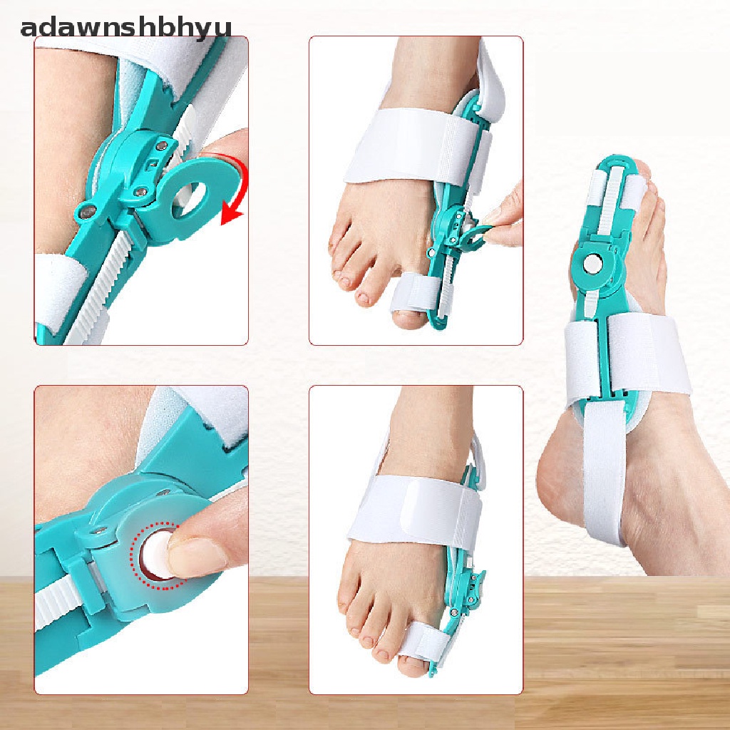 1 Dụng Cụ Nẹp Điều Chỉnh Ngón Chân Cái Bunion
