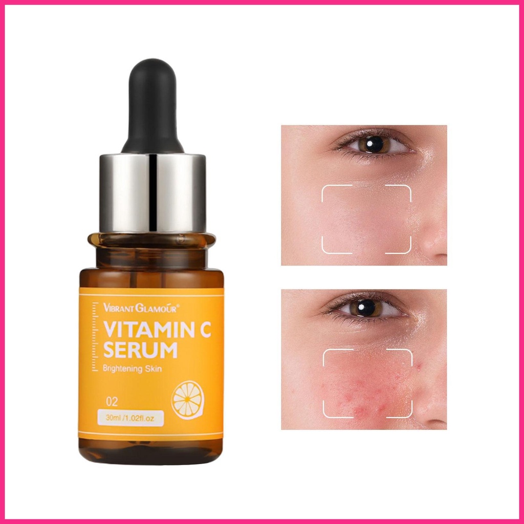 Tinh Chất Vitamin C Giúp Da Săn Chắc Và Sáng Mịn
