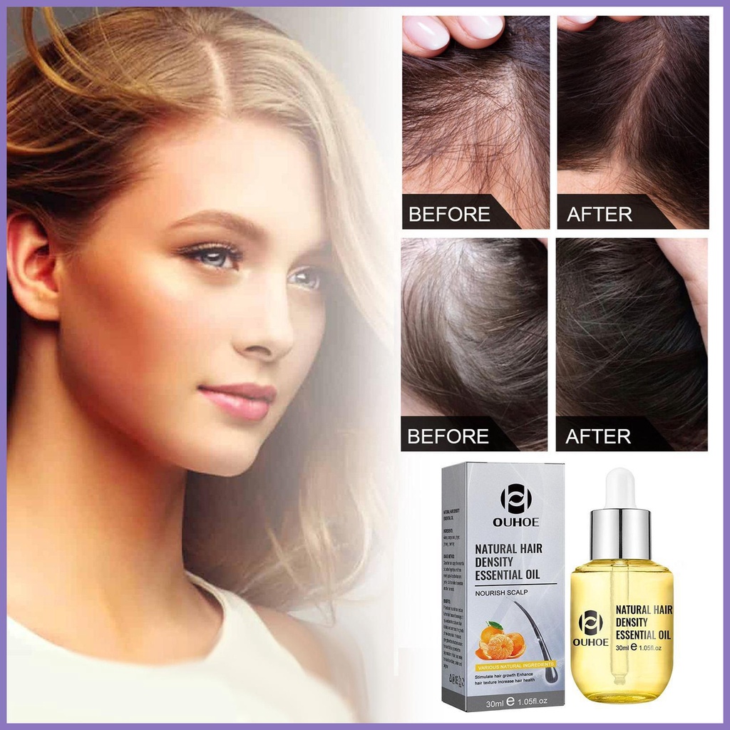 Tinh Chất Kích Thích Mọc Tóc 30ml An Toàn Cho Tóc Dày Hơn Và Rụng Tóc nota2vn