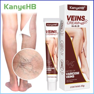 ⚡⚡COD kanyehb Kem giãn tĩnh mạch giảm đau viêm mạch viêm tĩnh mạch sửa chữa Thuốc mỡ Giun đất Nhện Chân làm mịn mạch máu phồng lên điều trị Thảo Dược Chăm sóc thạch cao y tế 20g