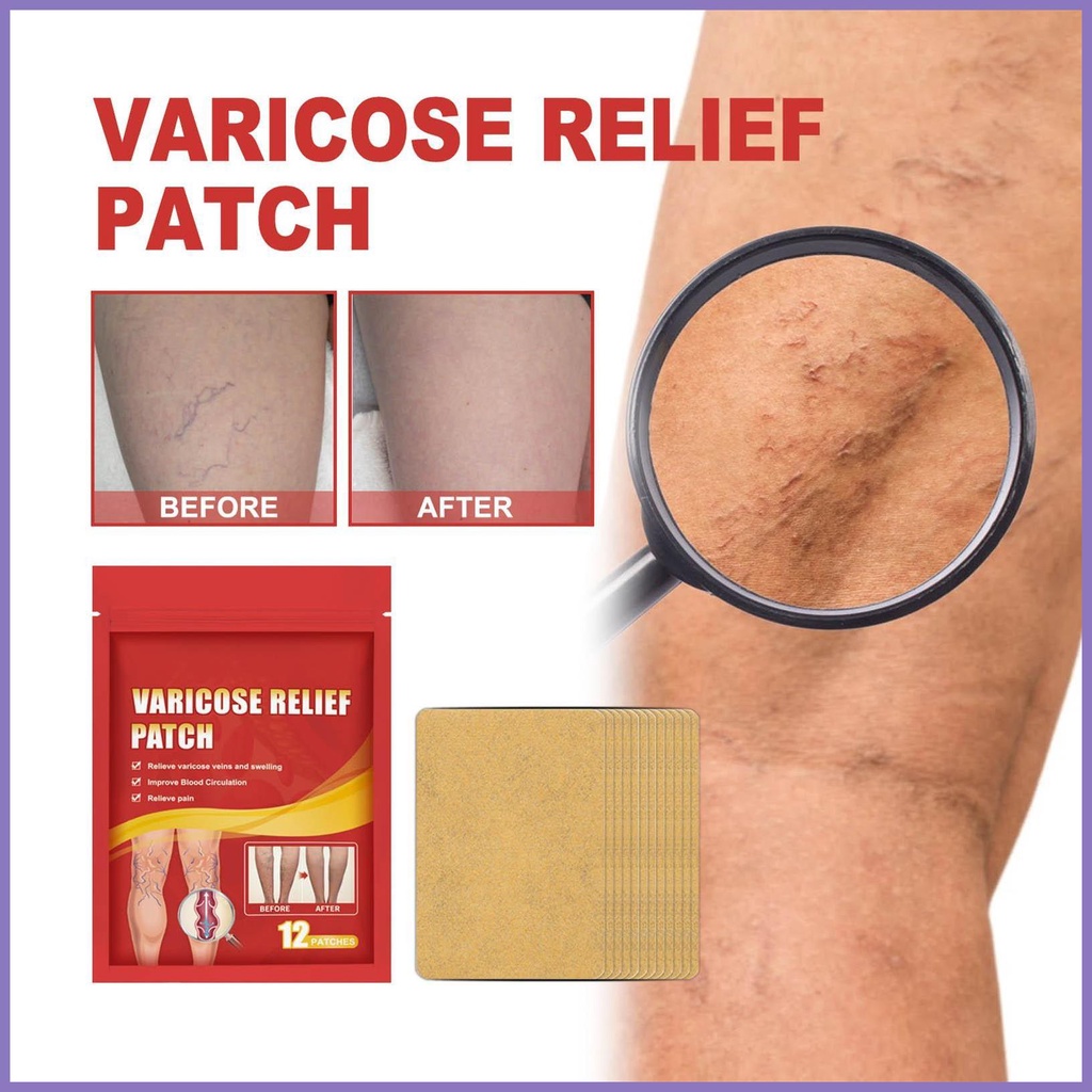 Bộ 12 Miếng Dán Giảm Giãn Tĩnh Mạch Cho Nam Nữ nota2vn