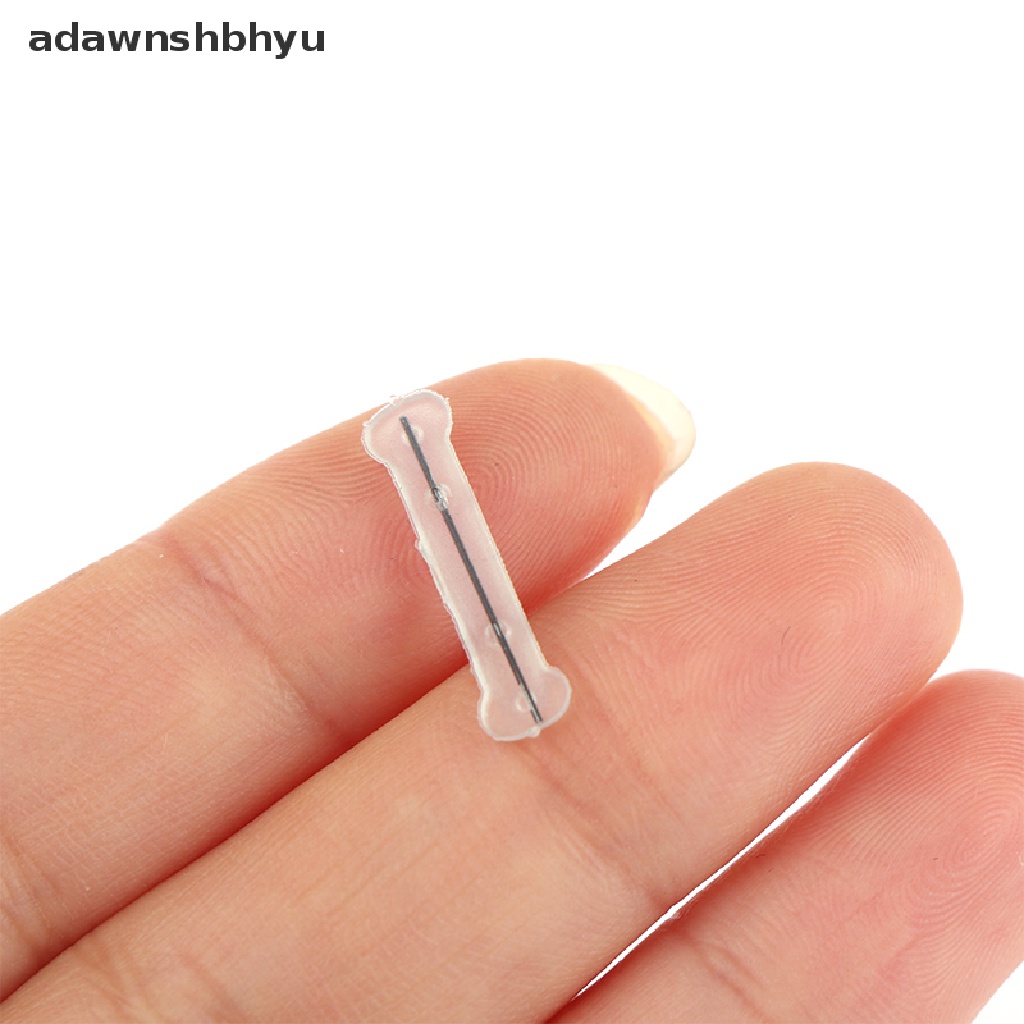 Dụng Cụ Kẹp Nẹp Chỉnh Sửa Móng Chân Mọc Ngược adawnshbhyu