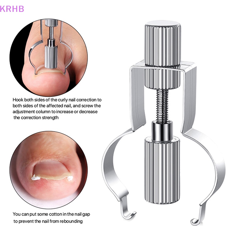 Dụng Cụ Định Hình Móng Chân Mọc Ngược Mới