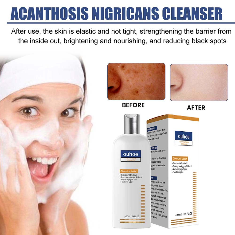 50ml Cleansing Lotion Moisturizing Relieving Dry Skin Facial Exfoliation Lighten Dark Pigmentation Facial Cleanser