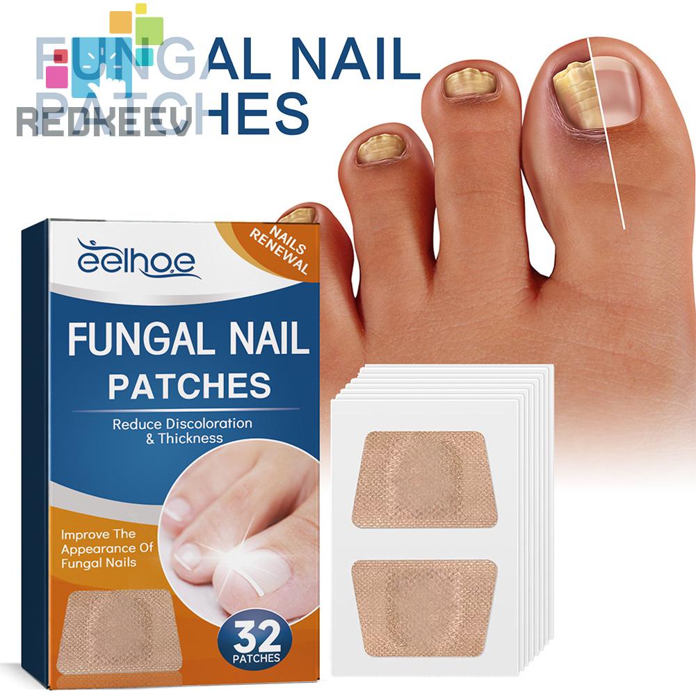 Bộ 32 Miếng Dán Điều Chỉnh Móng Tay Co Giãn Thoáng Khí Dễ Sử Dụng