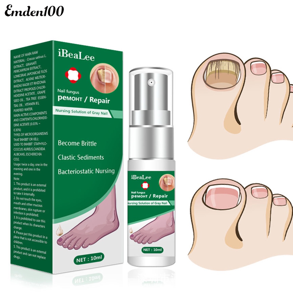 Dung Dịch Kháng Khuẩn 10ml Dễ Sử Dụng Cho Chăm Sóc Móng Tại Nhà