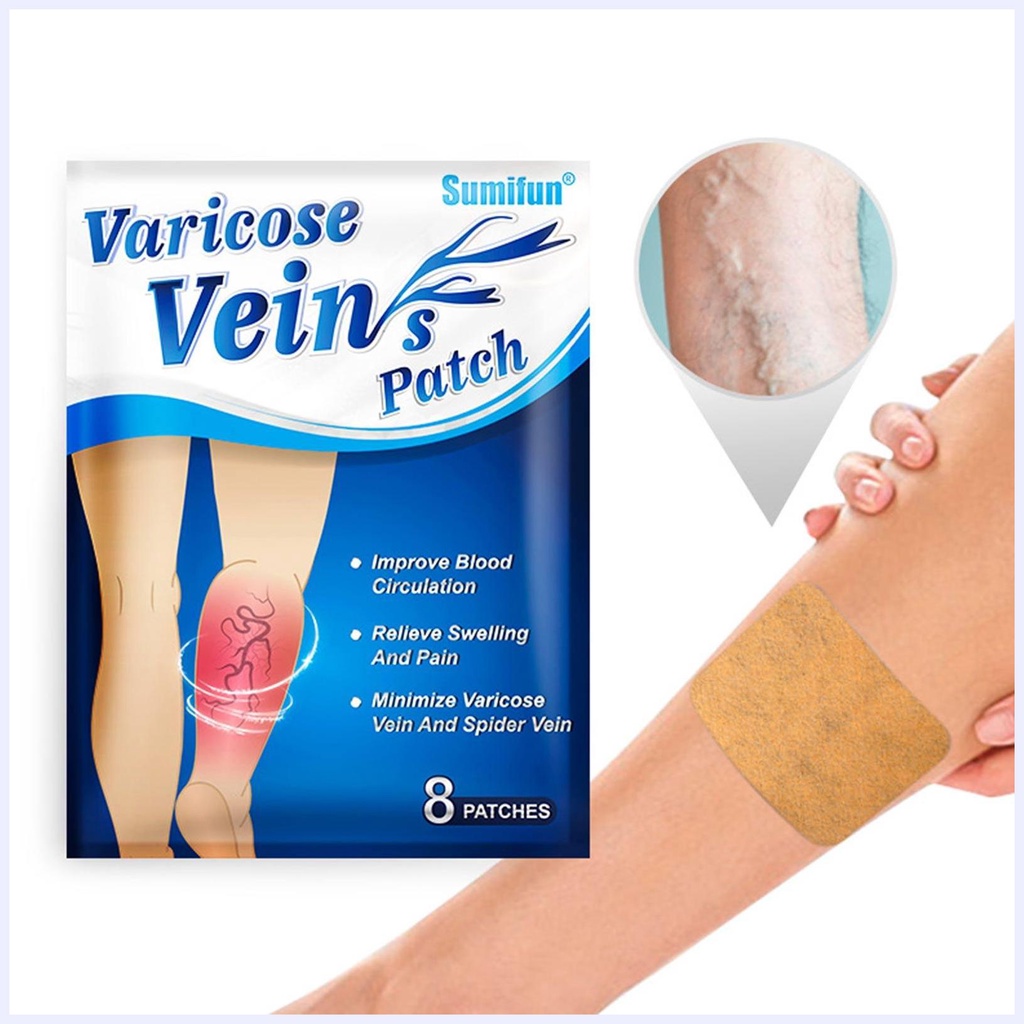 Miếng Dán Trị Giãn Tĩnh Mạch Trung Hoa Hiệu Quả