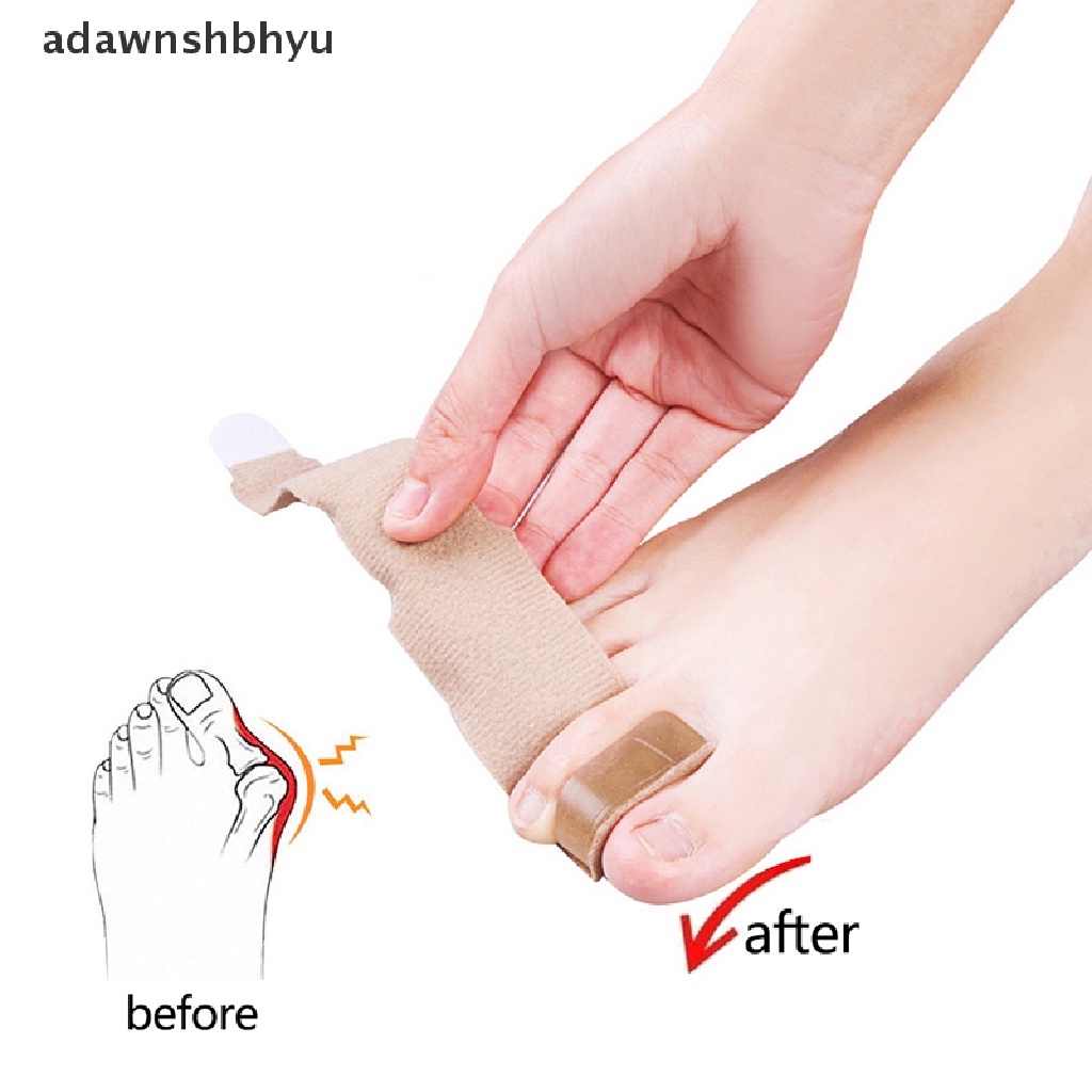 1 Đai Nẹp Chỉnh Hình Ngón Chân Cái