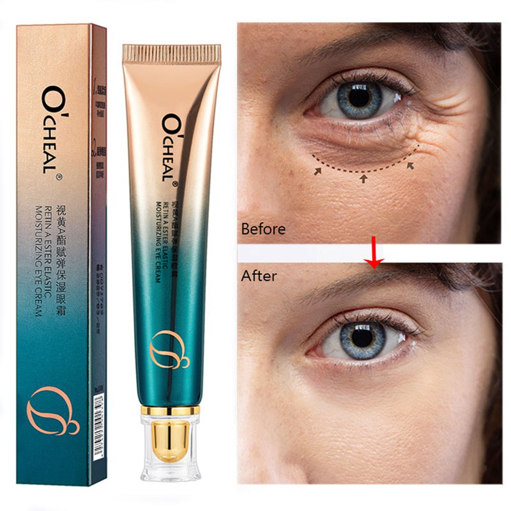 Anti-wrinkle aging moisturizing eye cream fading phins lines xóa quầng thâm túi làm săn chắc da 30g