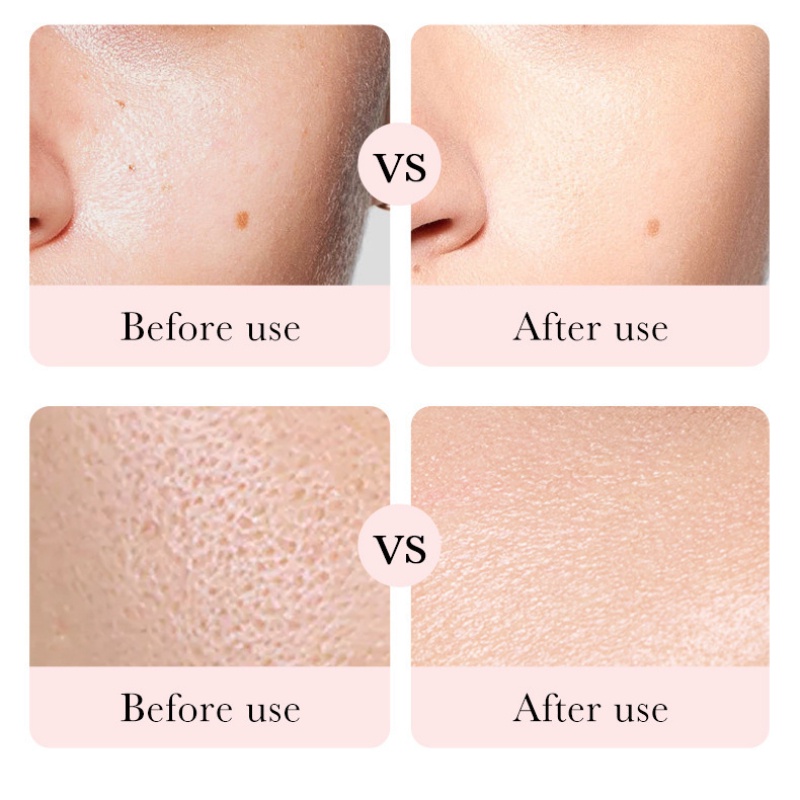 Bioaqua rose hyaluronic acid moisturizer cream hydrating làm sáng tông màu da thu nhỏ lỗ chân lông 50g