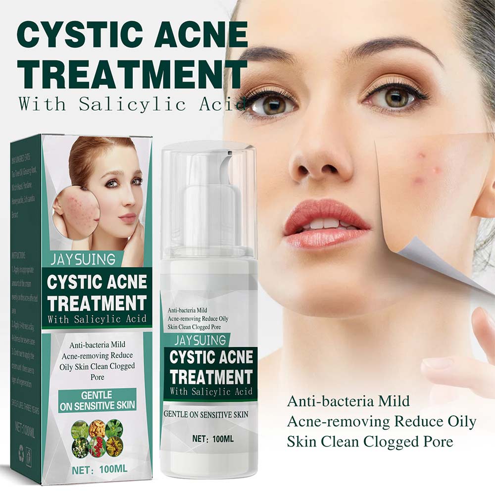 2pcs/100ml jaysuing salicylic acid cystic acne cream facial repair cream