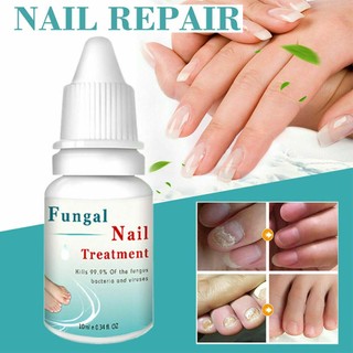 Lianbiquan LANTHOME nail care repair solution for cracked and rough nails, discolored nails, and separated nails
