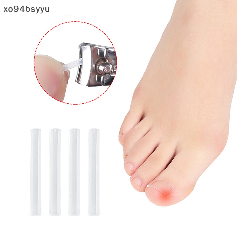 Set 10 Miếng Dán Chỉnh Sửa Móng Chân Xo94Bsyu