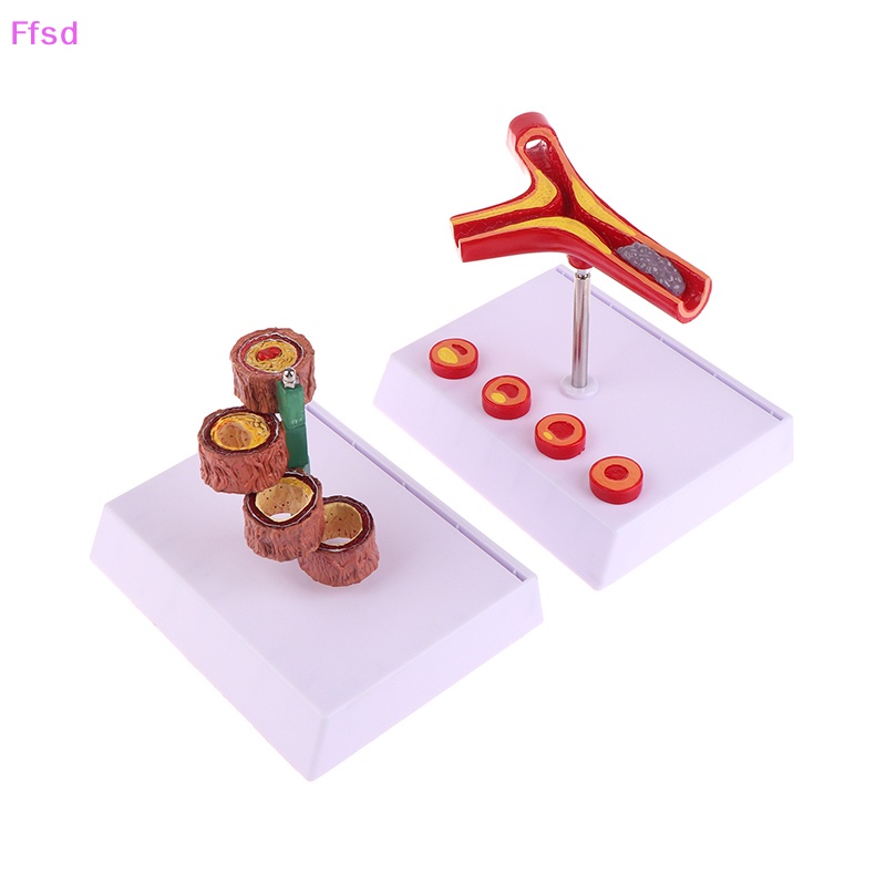 Tượng Vessel Con Người Nối Dài 50 Lần Cho Phòng Thí Nghiệm