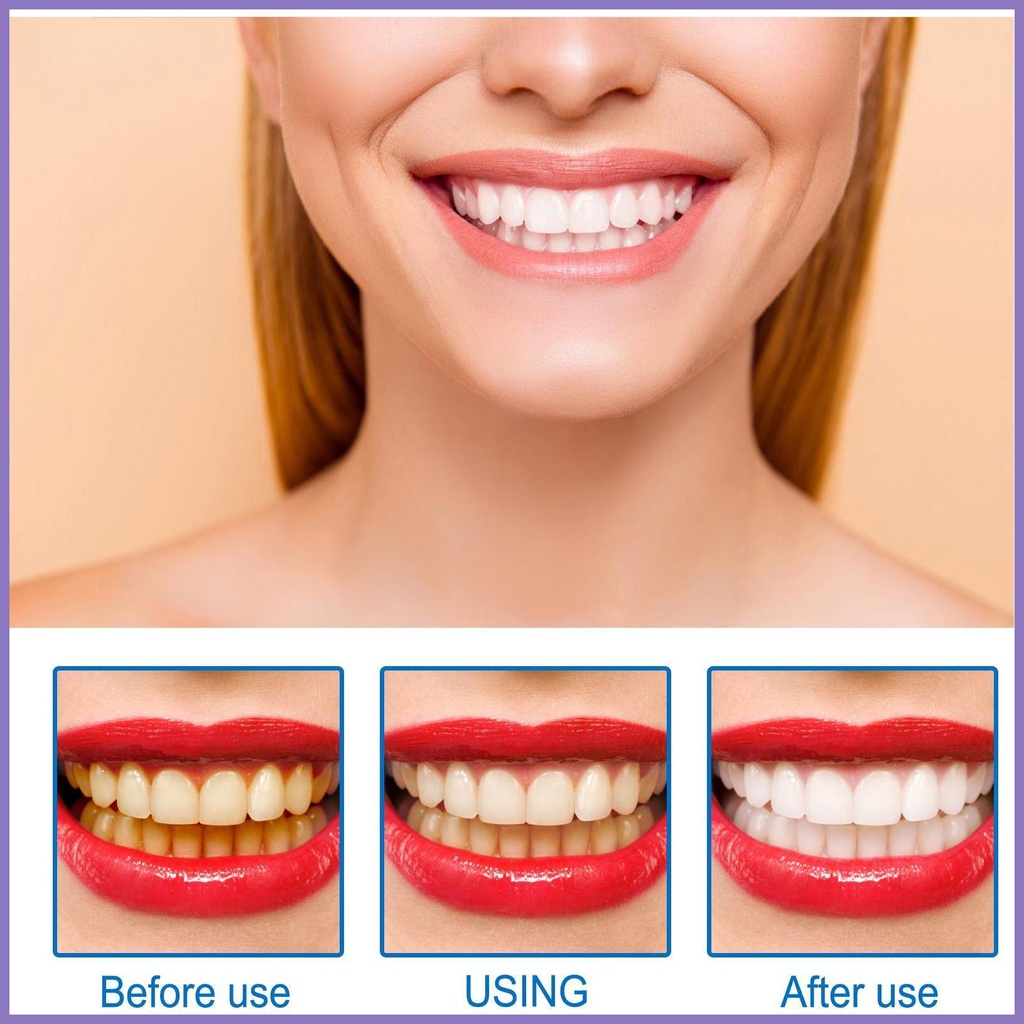 Tinh Chất Làm Trắng Răng Loại Bỏ Vết Bẩn Trên Răng Ngăn Ngừa Caries Tươi Mới nota2vn
