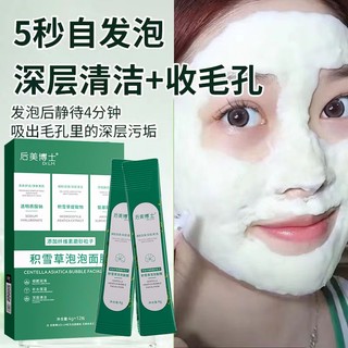 Bán Chạy Đặc Biệt#现货积雪草微酸小气泡面膜去黑头去粉刺深层清洁收缩毛孔闭口泥膜正品#正品7. 25yy