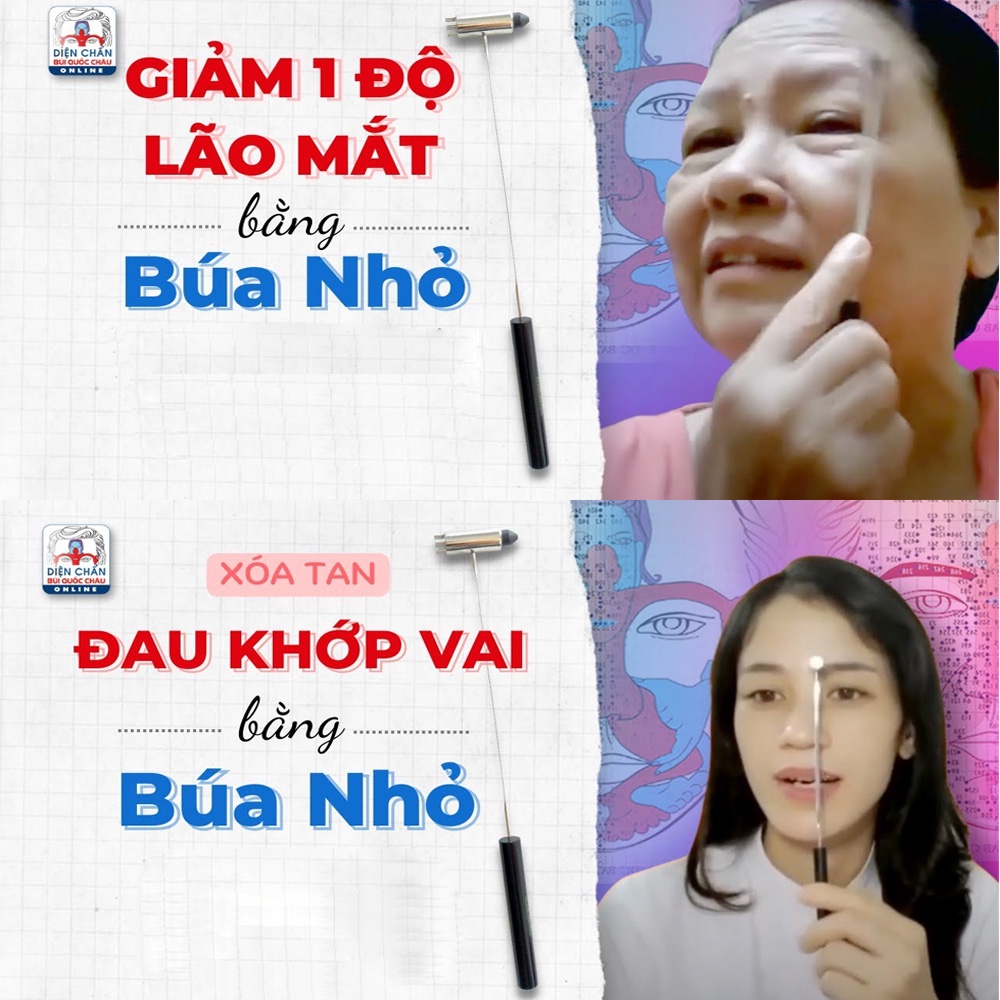 Dụng Cụ Diện Chẩn Búa Hoa Mai - Búa Nhỏ - Búa Gôm Gai
