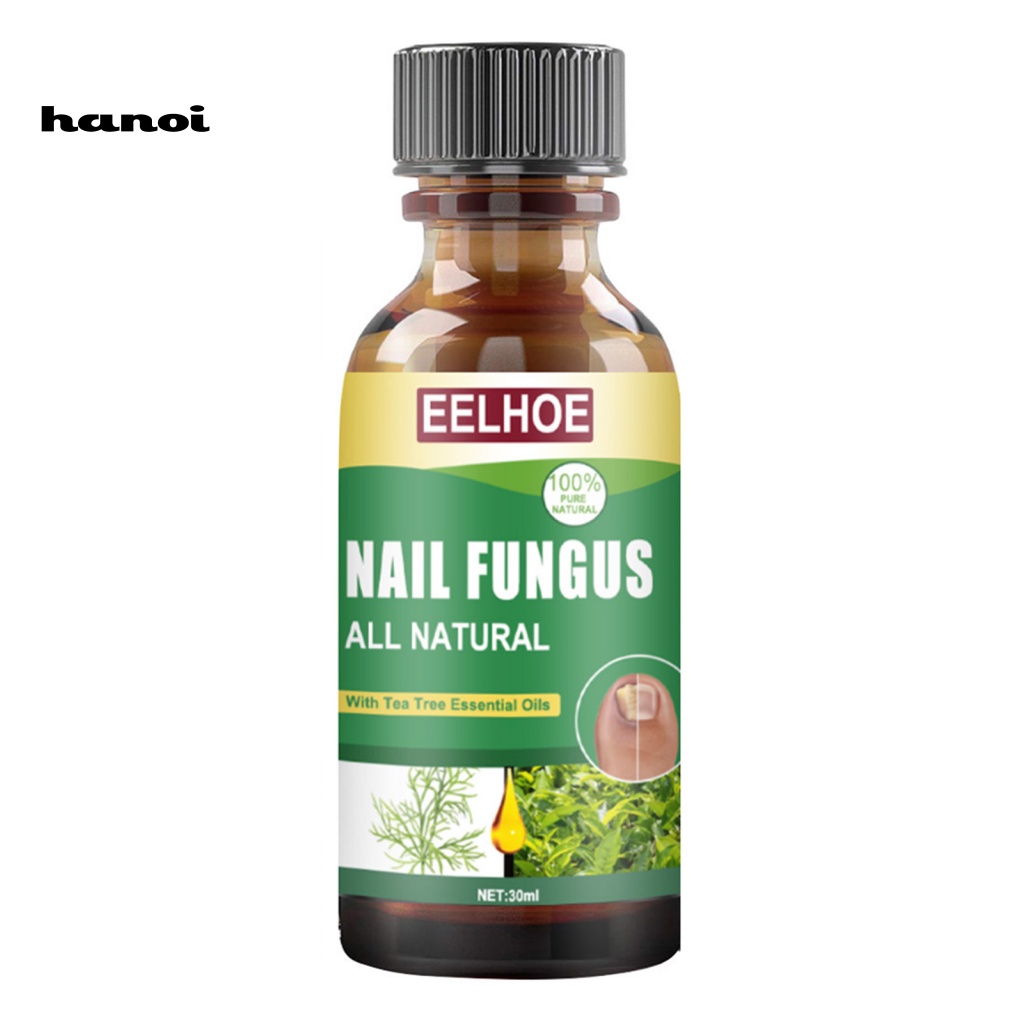 Tinh Chất Hỗ trợ giảm nấm Móng 30ml Giúp Làm Trắng Và Chống Nhiễm Trùng Cho Nam Và Nữ