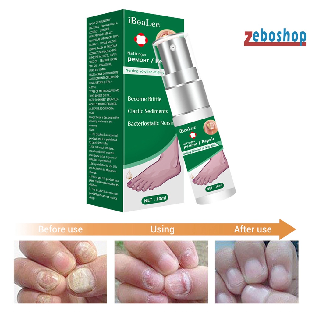 Dung Dịch Kháng Khuẩn 10ml Dễ Sử Dụng Cho Chăm Sóc Móng Tại Nhà