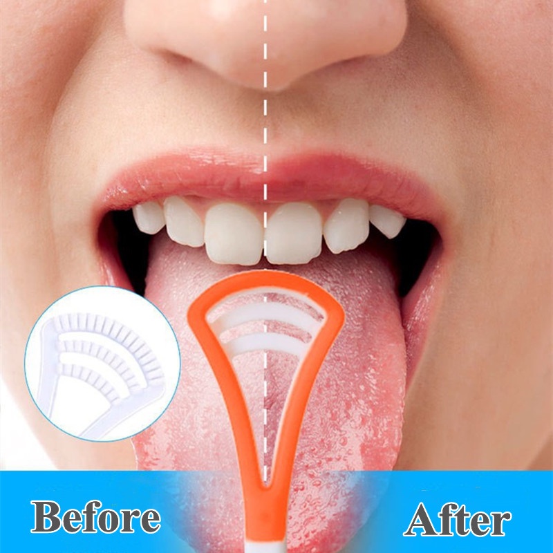 Bàn Chải Vệ Sinh Lưỡi Tay Cầm Dài Không Trượt Chất Lượng Cao Cho Thanh Thiếu Niên Và Người Lớn