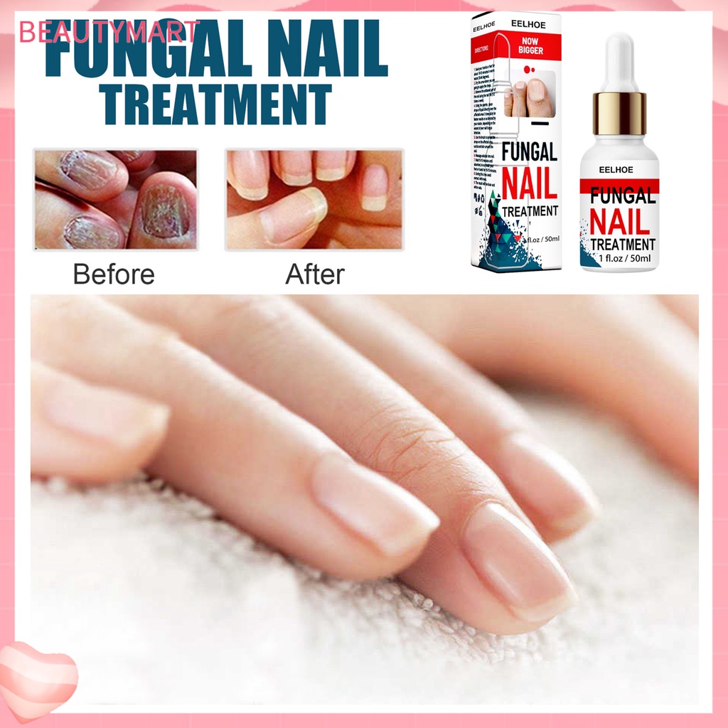 Tinh Dầu Dưỡng Ẩm Chăm Sóc Móng Tay 50ml Thành Phần Tự Nhiên Không Gây Kích Ứng