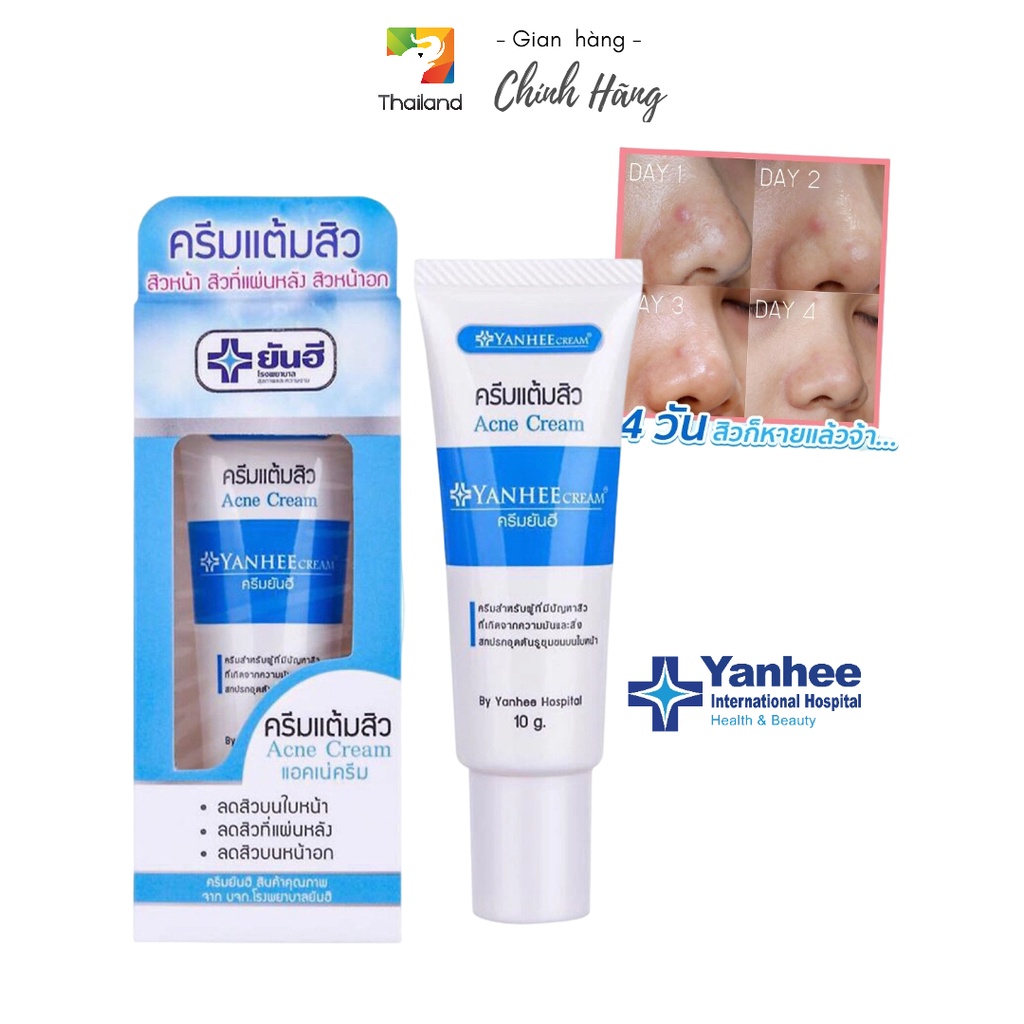 Kem bôi mụn Yaņhee Acne Cream 5g