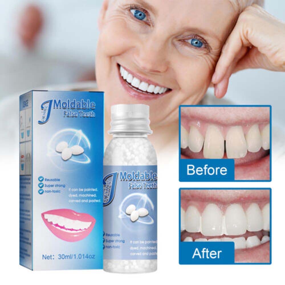 30ML Temporary Tooth Repair Kit Teeth and Gaps Moldable Falseteeth Solid Glue Denture Adhesive
