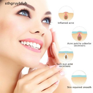 Bộ 36 miếng dán mụn hydrocolloid và mụn thịt dư
 vn vn