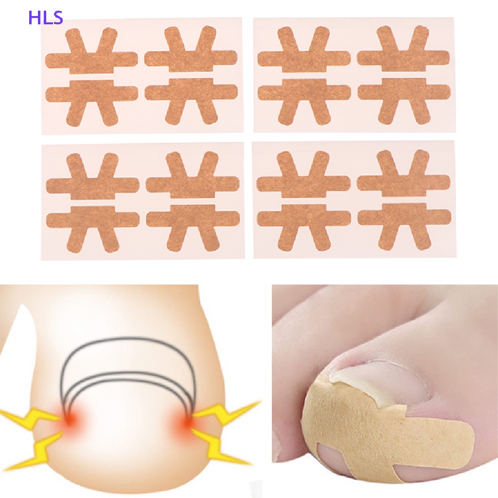 Set 4 Miếng Dán Chỉnh Sửa Móng Chân Không Keo Tiện Dụng
