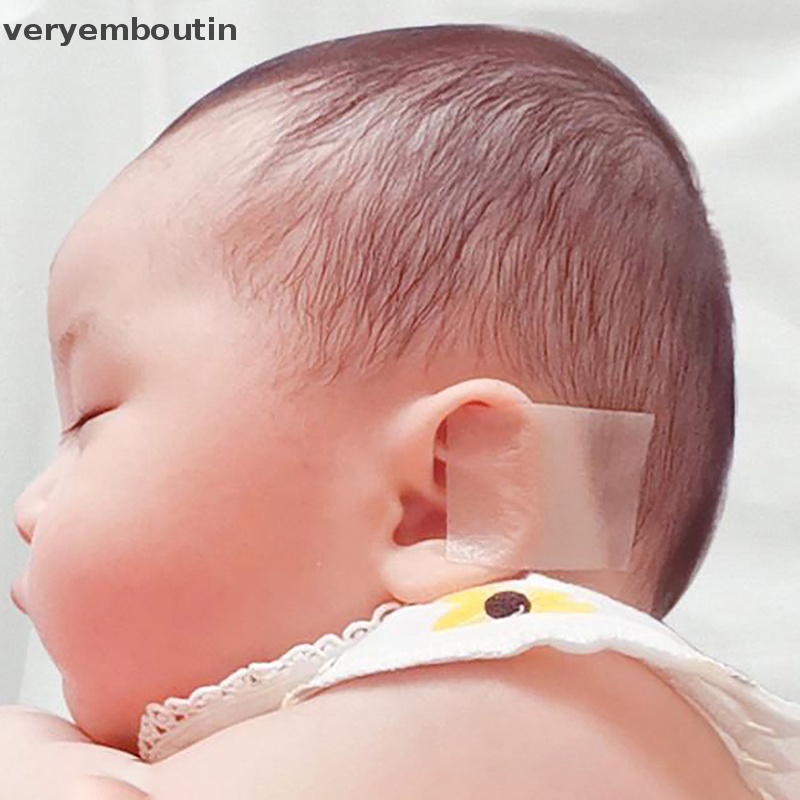 Dụng Cụ Chỉnh Sửa Tư Thế Tai Cho Bé Sơ Sinh