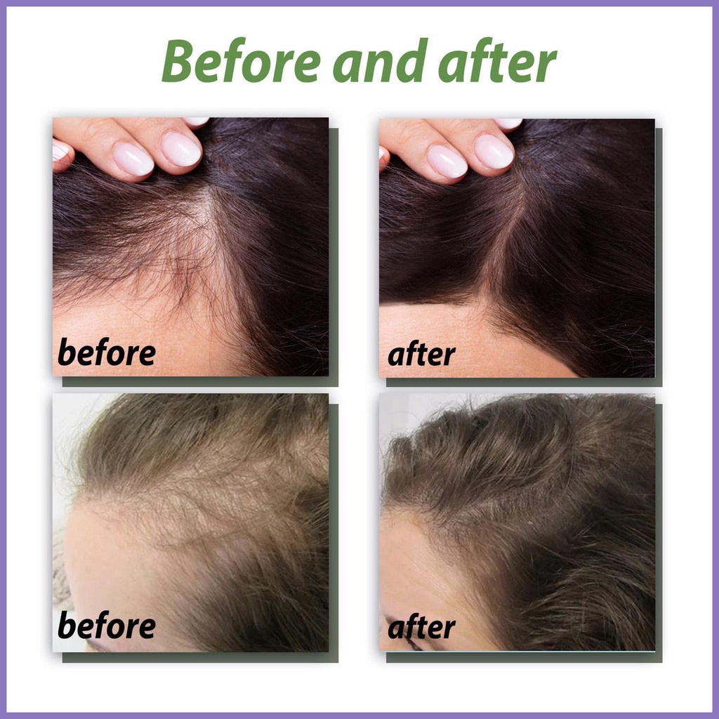 Tinh Chất Kích Thích Mọc Tóc Và Nuôi Dưỡng Tóc Khô Hư Tổn Dr nota2vn