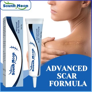 ⚡⚡COD SOUTH MOON Advanced Scar Formula Mờ Sẹo Rạn Da Loại Bỏ Kem Khắc Phục Các Đốm Mụn Trị Mụn Đầu Đen Làm Trắng Thuốc Mỡ Chiết Xuất Thảo Dược Tự Nhiên Chăm Sóc Da 15g