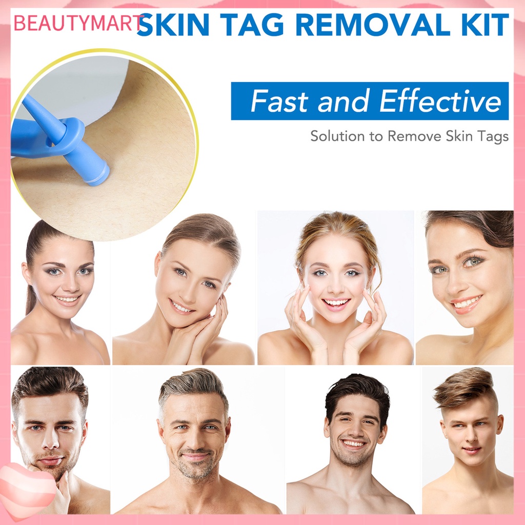 1 Bộ Dụng Cụ Loại Bỏ Mụn Cóc Trên Da Trọng Lượng Nhẹ Nhanh Chóng