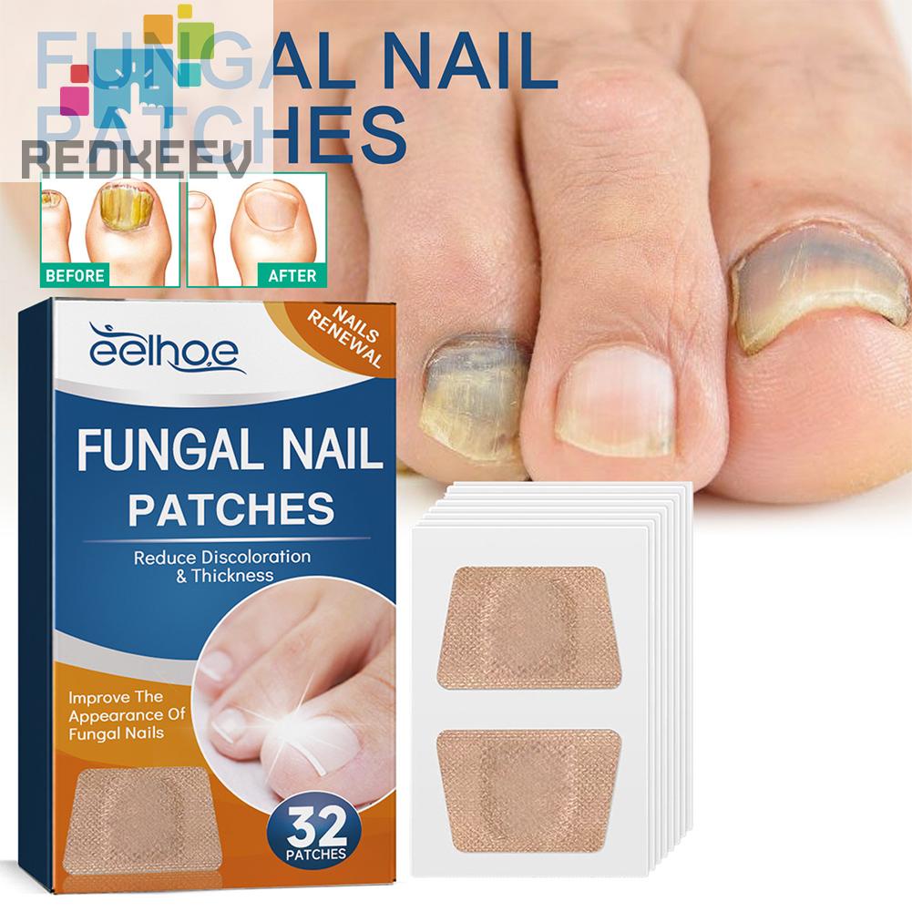 Bộ 32 Miếng Dán Điều Chỉnh Móng Tay Co Giãn Thoáng Khí Dễ Sử Dụng