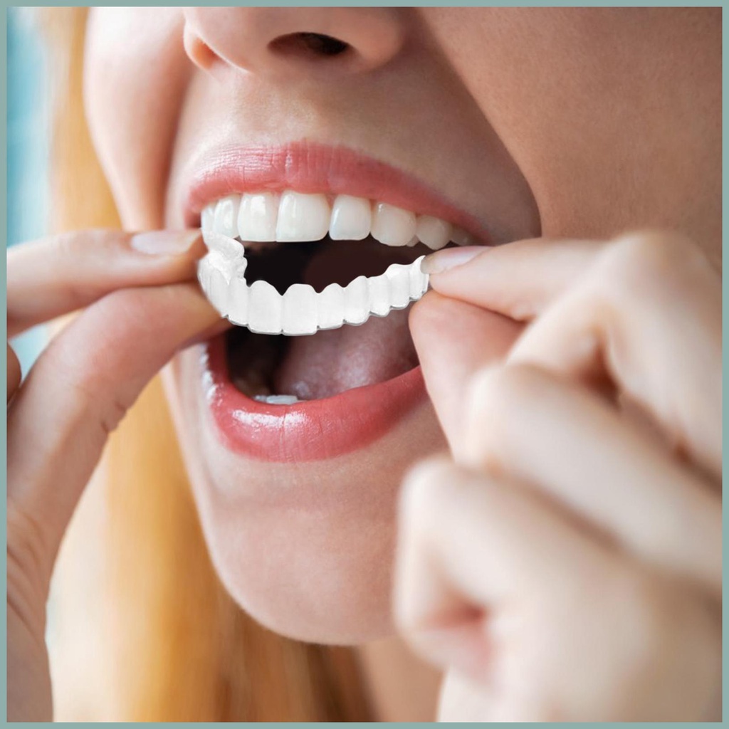 Hàm Răng Giả Tạm Thời Thay Thế An Toàn Cho yunvn