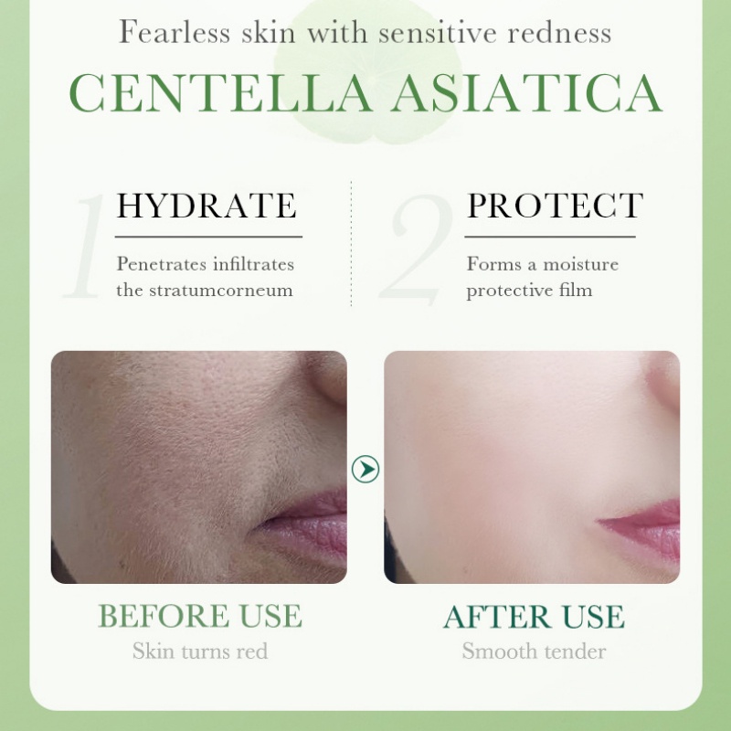 Bioaoua centella Asiatica Facial Moisturizer lotion dưỡng ẩm cho da khô da nhạy cảm có sẵn 80ml