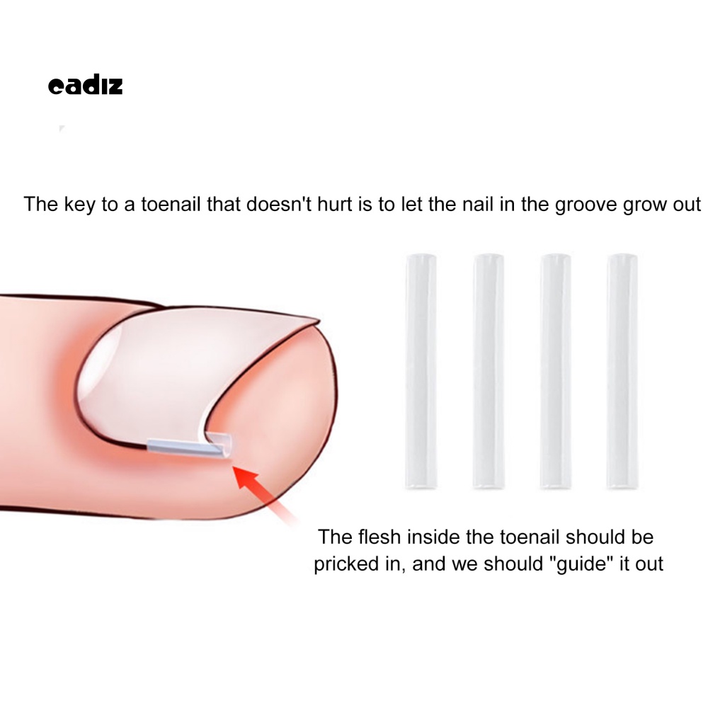 Set 10 Miếng Dán Chỉnh Sửa Móng Chân Tiện Dụng