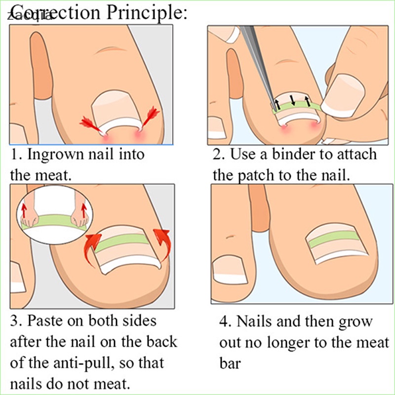 Set 10 Miếng Dán Chỉnh Sửa Móng Chân 13-20mm Tiện Dụng