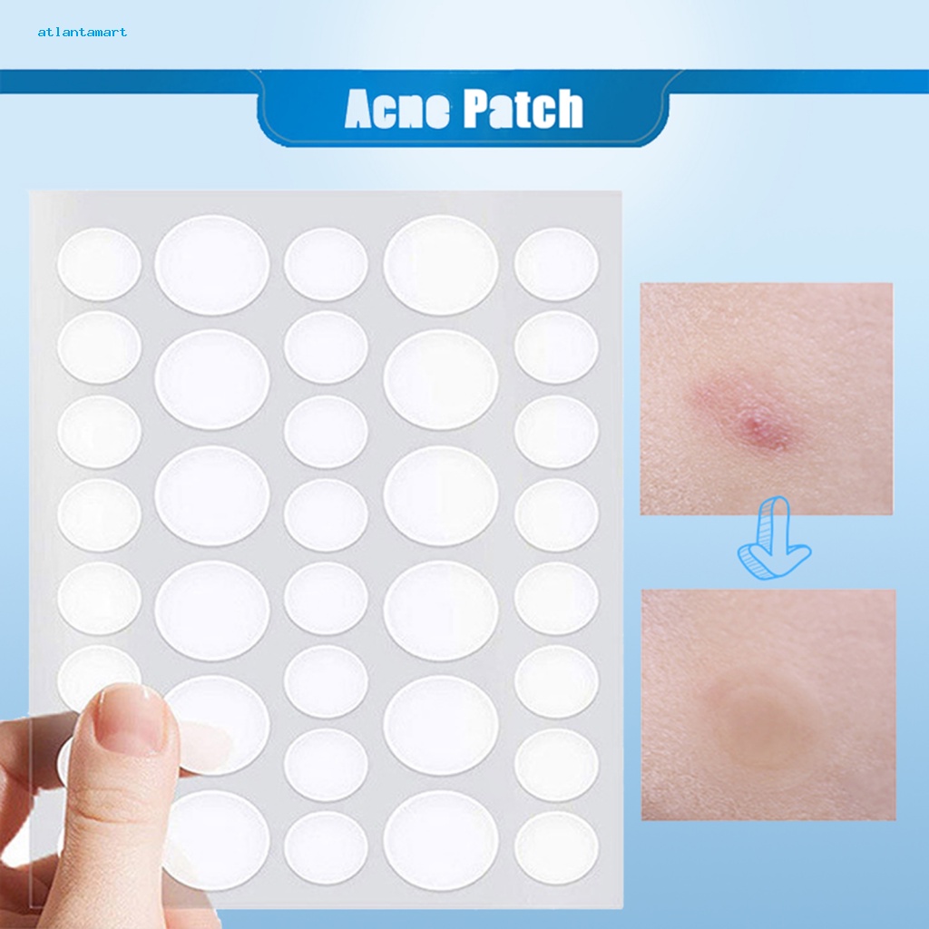 Túi Đựng Đồ Dùng Cao Cấp Tiện Dụng| Set 36 Miếng Dán Hỗ trợ giảm mụn Siêu Mỏng Chống Thấm Nước