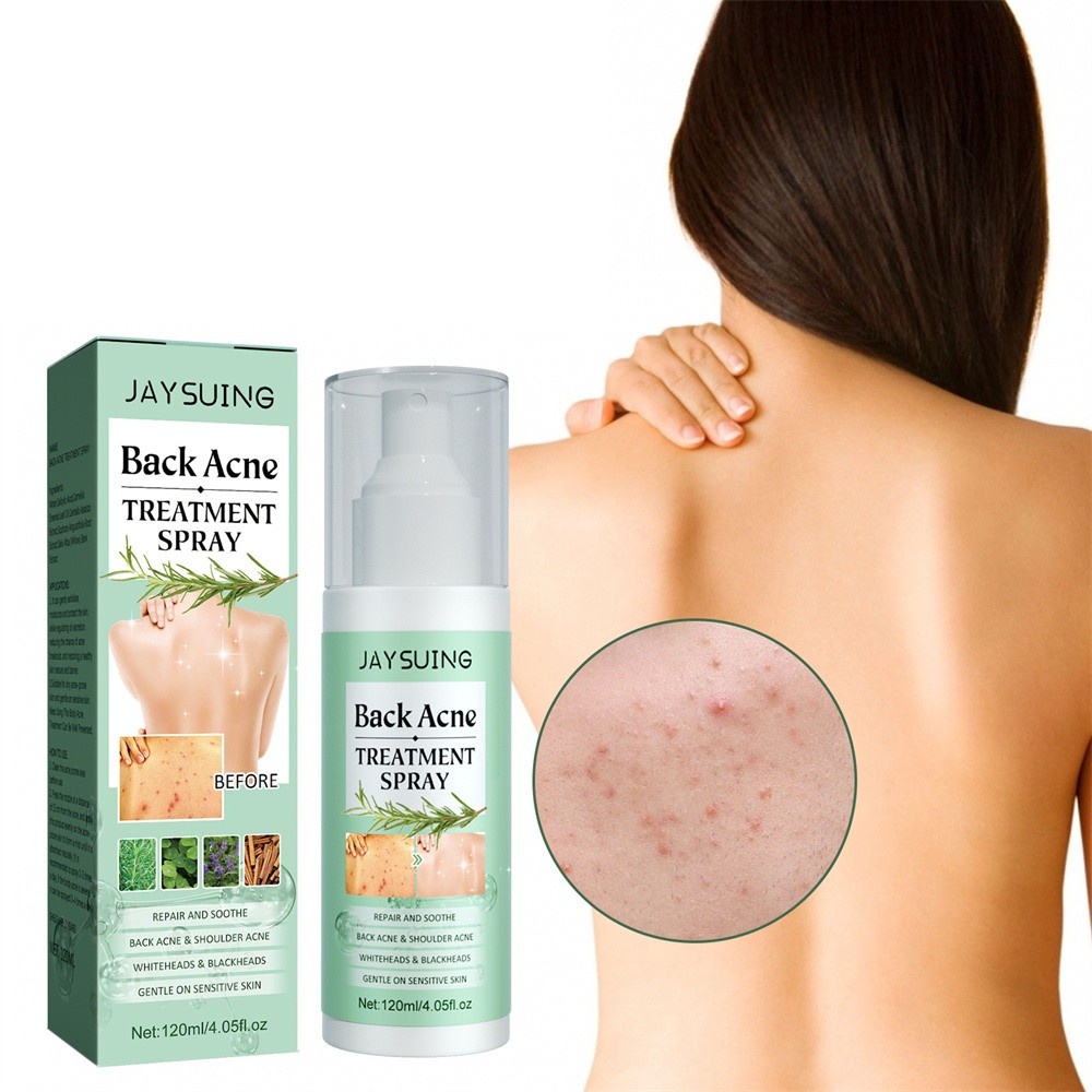 Xịt giảm mụn/ sẹo JULYSTAR phục hồi và làm sáng/ chăm sóc da cho vùng lưng/ vai 120Ml