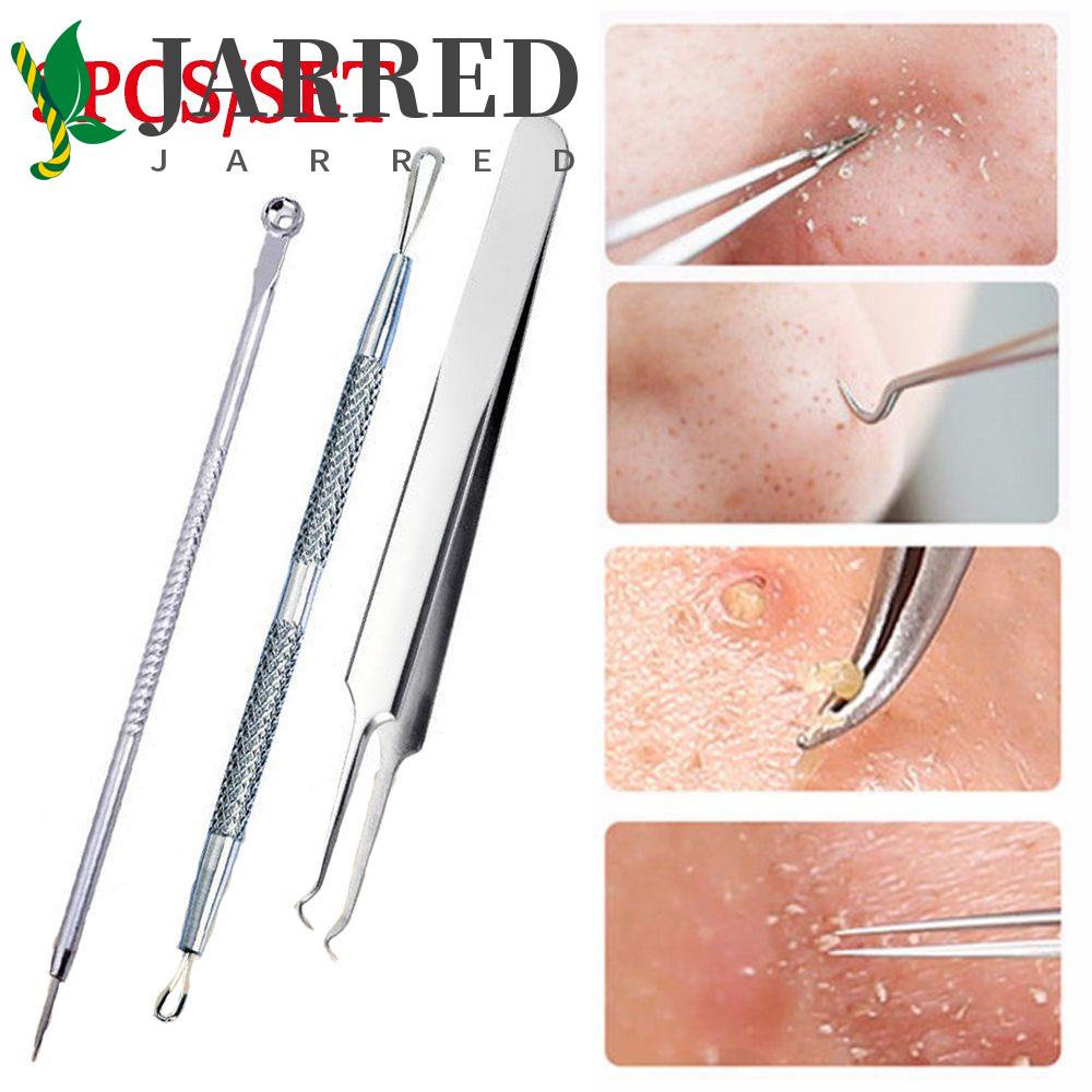 JARRED Bộ 3 Dụng Cụ Hỗ Trợ Giảm Mụn Đầu Đen Chăm Sóc Da Chuyên Nghiệp