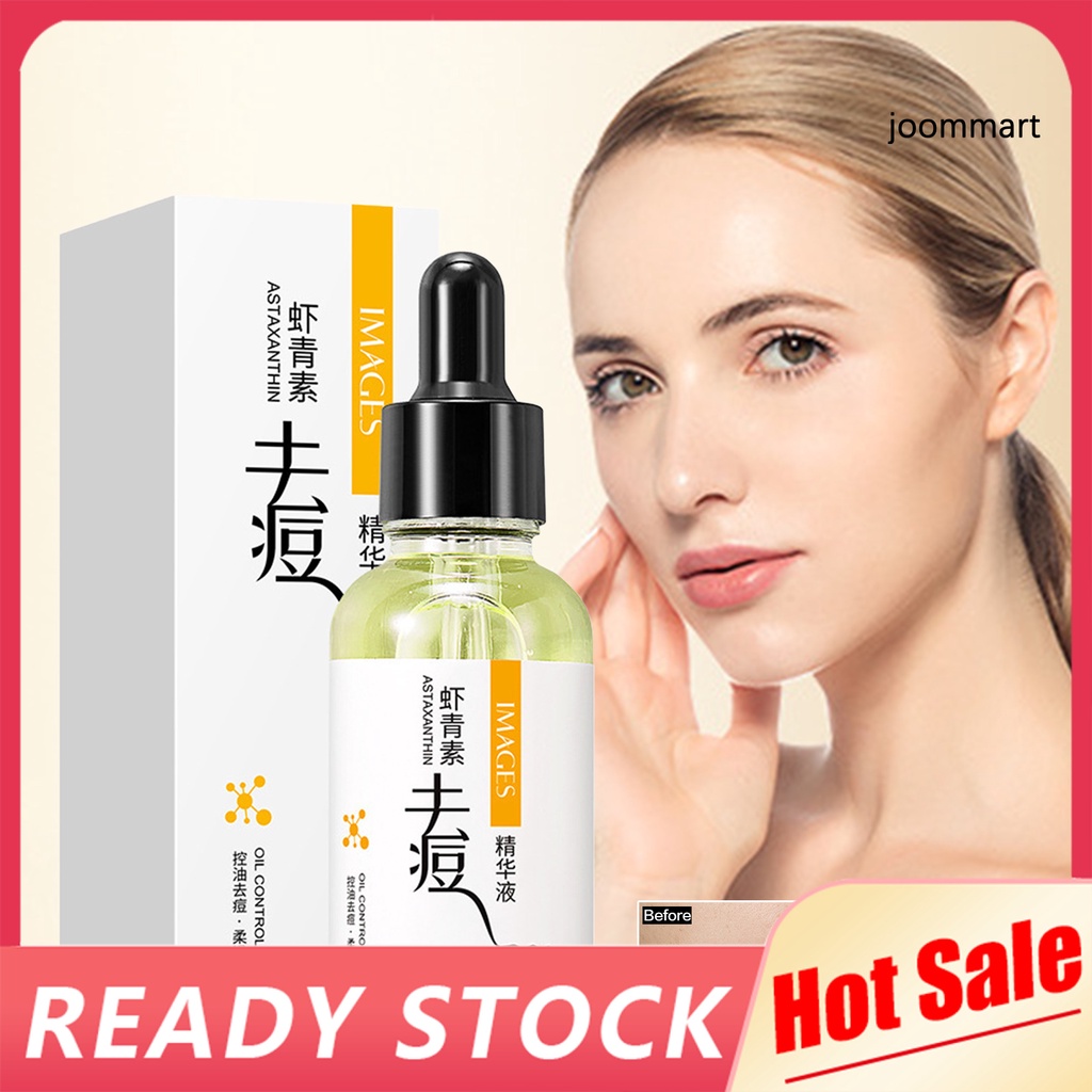 Phụ Kiện Chuyên Dụng Dành Cho Xe Jo Jo Jo☪Tinh Chất Dưỡng Ẩm Làm Trắng Da 30Ml Làm Mờ Nếp Nhăn Dưỡng Ẩm Loại Bỏ Tàn Nhang